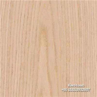 Muhandislik Recon EV Veneer